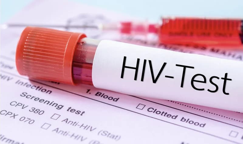 Ghana AIDS Commission Reports Surge in HIV Infections in Bono Region; 1,145 New Cases Recorded in Five Months