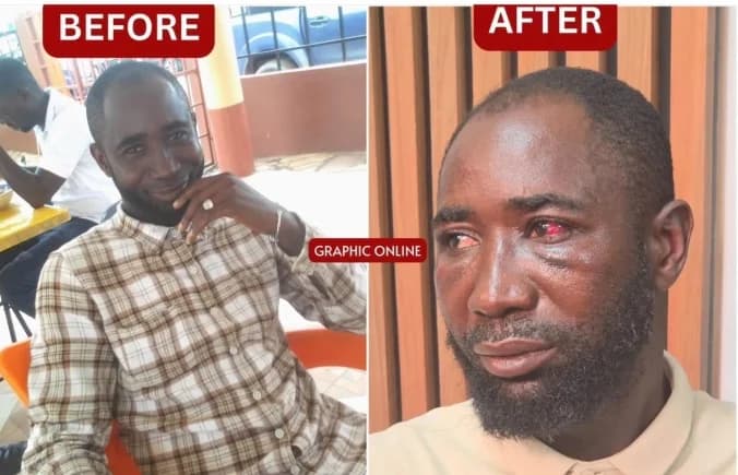 VIDEO: Before and after alleged police brutality of a Graphic staff in Accra