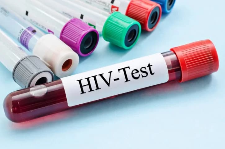 HIV patients not on treatment – New report reveals