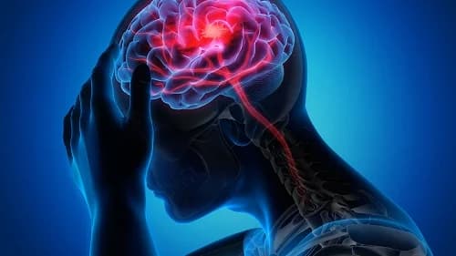 Stroke rises among men aged 30-49 - Health expert