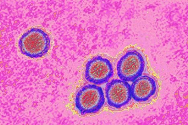 MP Mohammed Issah Bataglia Urges Swift Action After Yellow Fever Outbreak Kills Seven in Sissala East