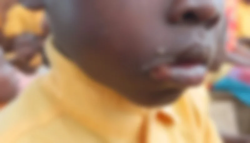 Mafi Kope residents appeal for medical help over rising skin infections